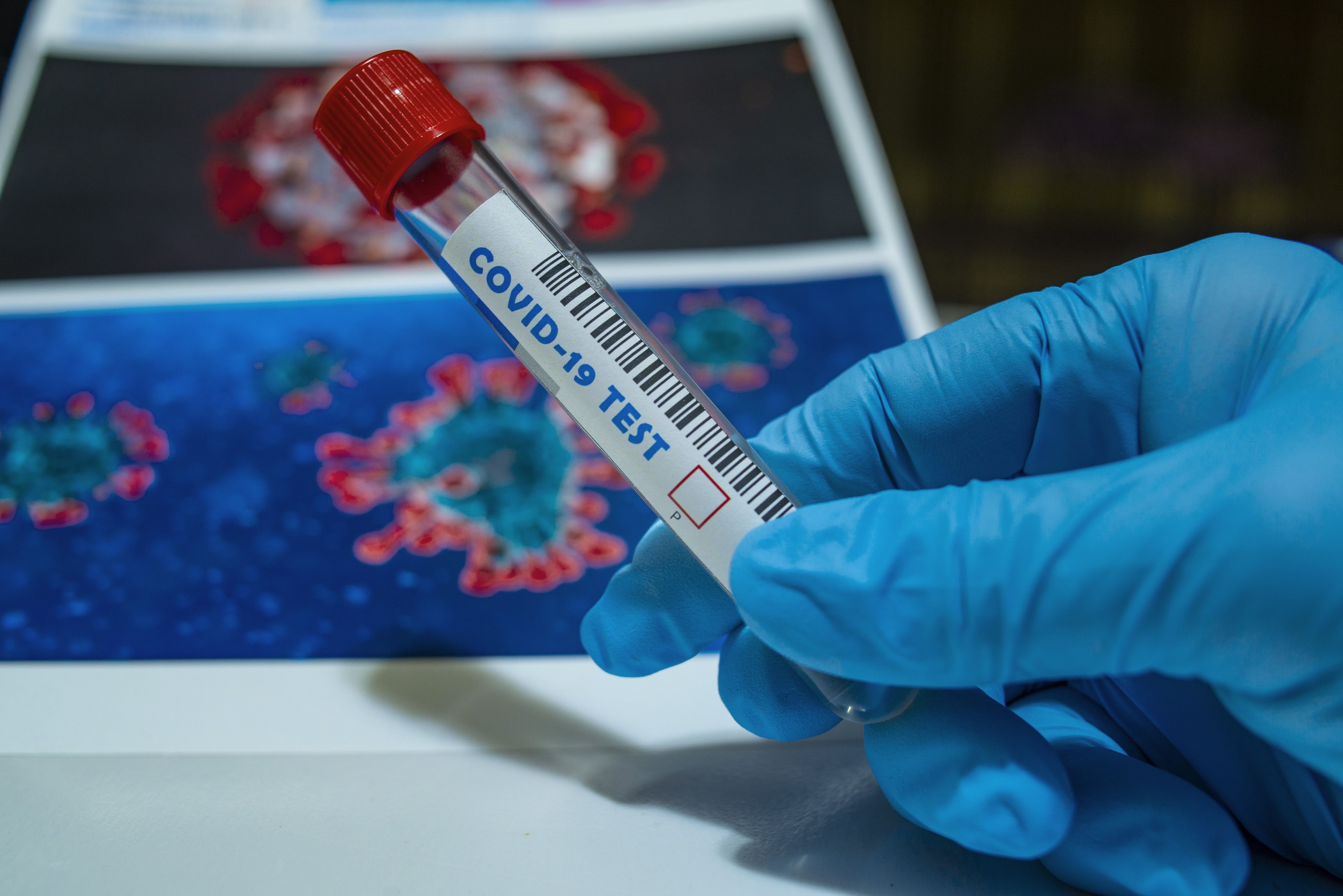 Recommended Reforms to the Vaccine Damage Payment Scheme and What They Mean for You
